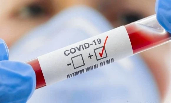 كورونا: 7 إصابات جديدة مع عدم تسجيل أي وفاة