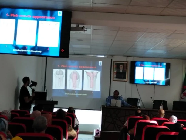 عشية الملتقى العربي ال19 لجراحة الاطفال بتلمسان ...اجراء 5عمليات جراحية لتشوه الجهاز التناسلي